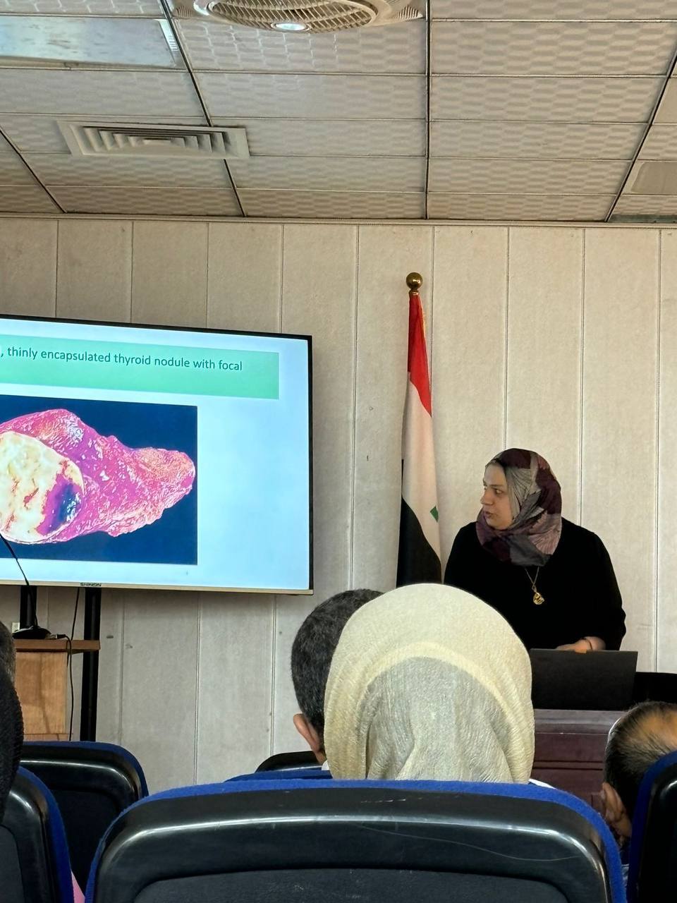 محاضرة اورام الغدة الدرقية