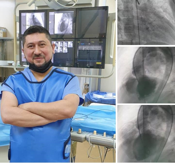 عملية غلق فتحة كبيرة بين البطينين